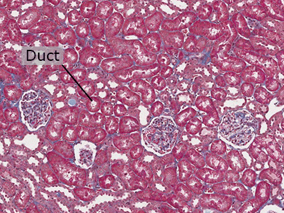 Renal Cortex Nephrons (epithelial tissue)