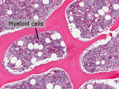small purple myeloid cells