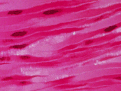 Smooth Muscle Cells