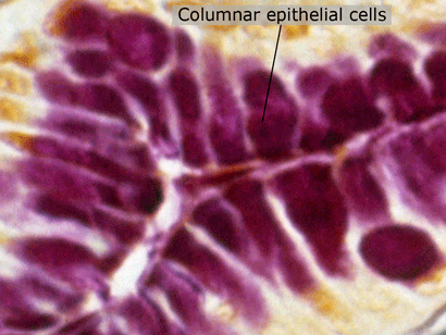 Columnar Epithelial Cells