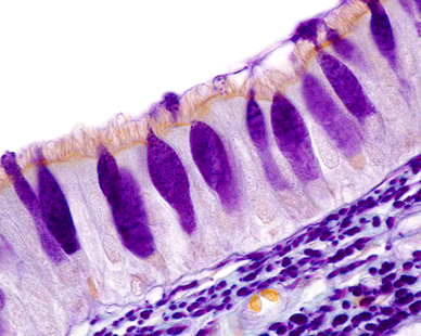 Mucosa Epithelial Tissue